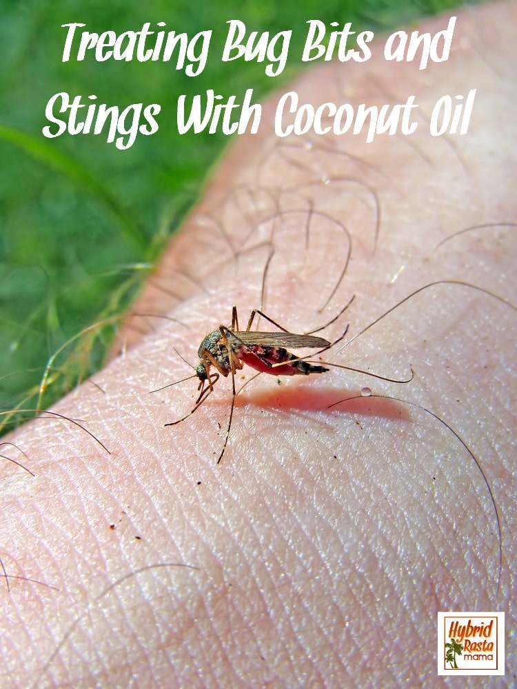 Treating Bug Bites and Stings With Coconut Oil by Hybrid Rasta Mama